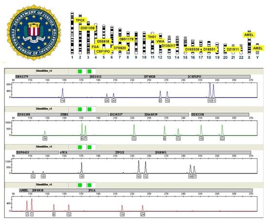 上：美国联邦调查局推荐使用的STR位点（Combined DNA Index System，CODIS)。下：一个典型的STR分析图谱（图片来源：维基百科）。