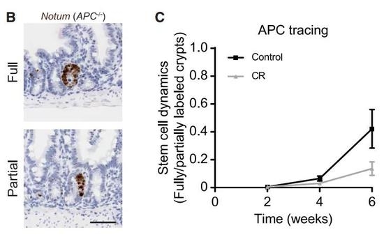APC缺失细胞在CR下更难存活