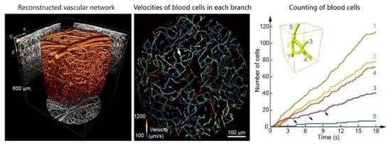 图3.（左）共聚焦光场显微镜拍摄得到的小鼠视皮层中的复杂血管网络。6个在不同深度拍摄的体积连接为一个深度达600 μm的三维结构。（中）100 μm到250 μm深度血管网络的平面投影，颜色代表不同血管分支中血细胞的平均流速。（右）图中箭头所指的区域中五个血管分支在一段时间内流过血细胞数量的计数。